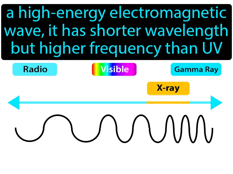 X-Ray Definition