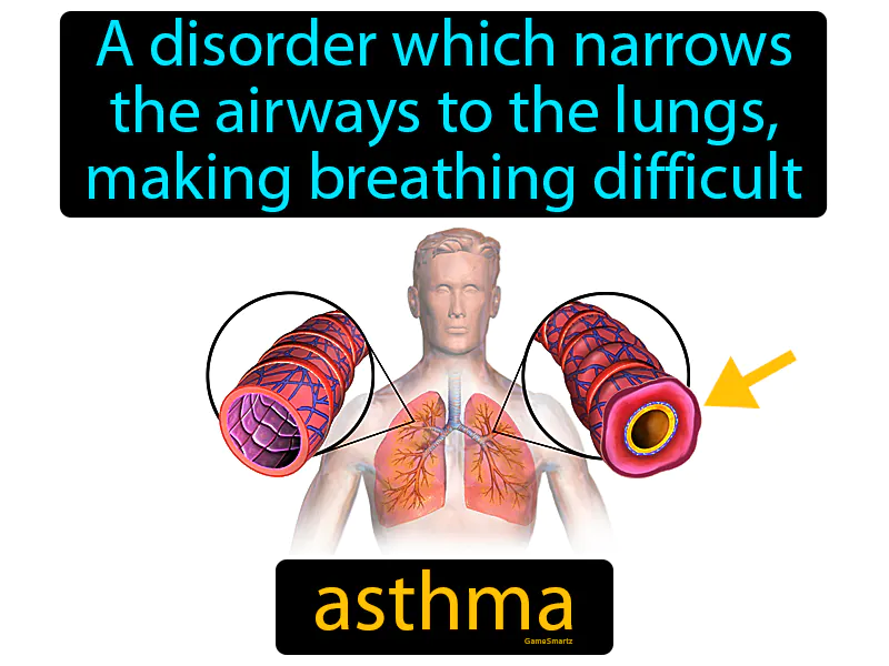 Asthma Definition Asthma Definition